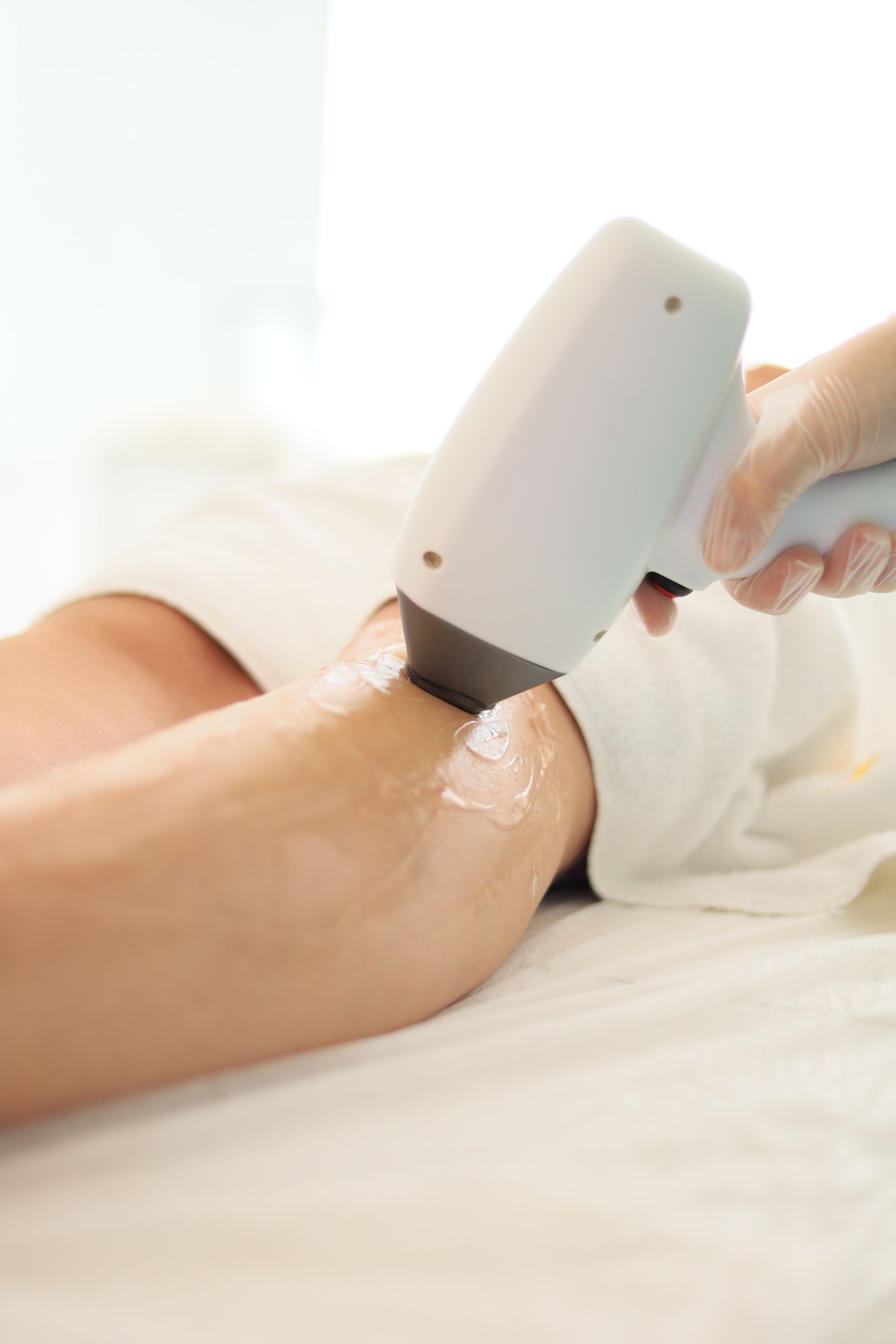 A laser hair removal handpiece on a leg