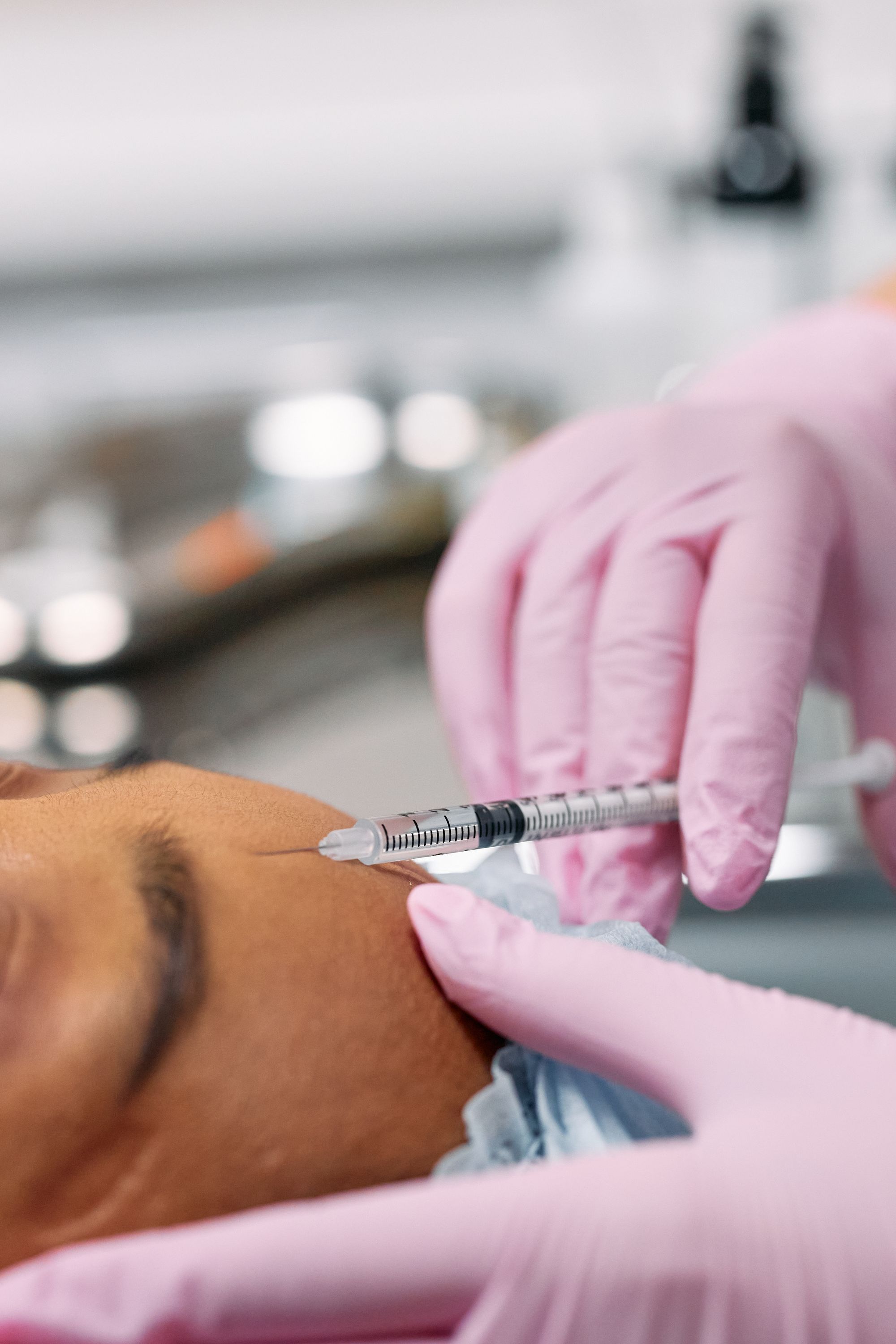 Close-up of a neurotoxin injection in the forehead