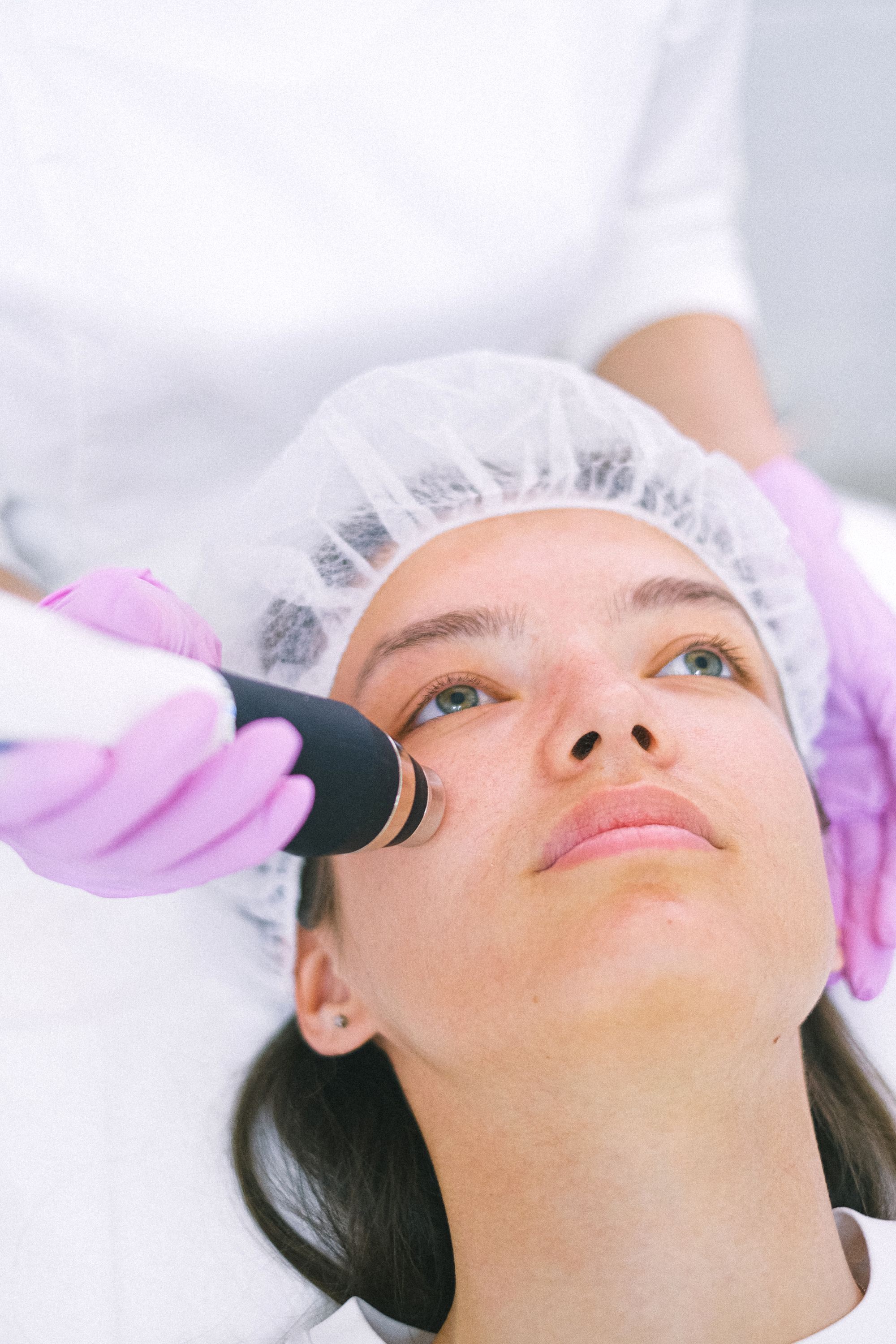 Close-up of a laser handpiece on a patient's cheek